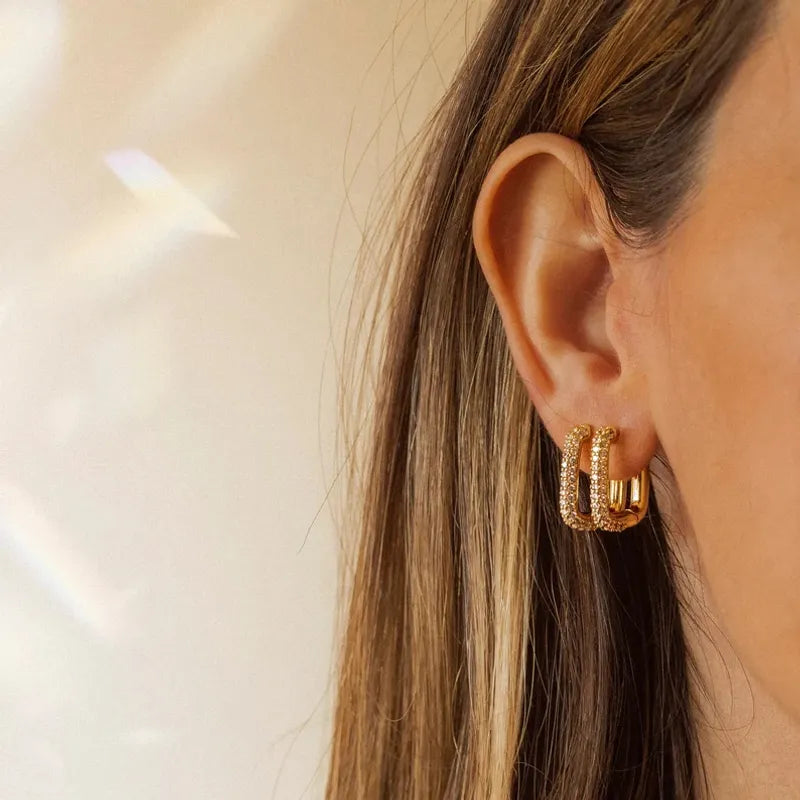 Aretes Oracle